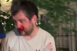 哥伦比亚vs葡萄牙_1直播_哥伦比亚vs葡萄牙_1免费观看_哥伦比亚vs葡萄牙_1高清回放8
